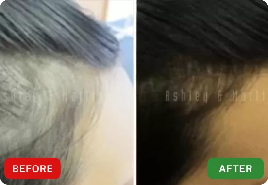 Before and After Kate