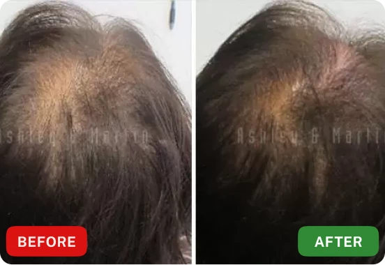 Before and After Megan